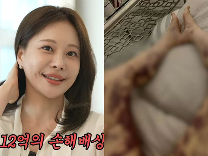 Nữ người mẫu kiêm YouTuber Aori chia sẻ về sự cố y khoa trong chương trình của Lee Ji Hye.