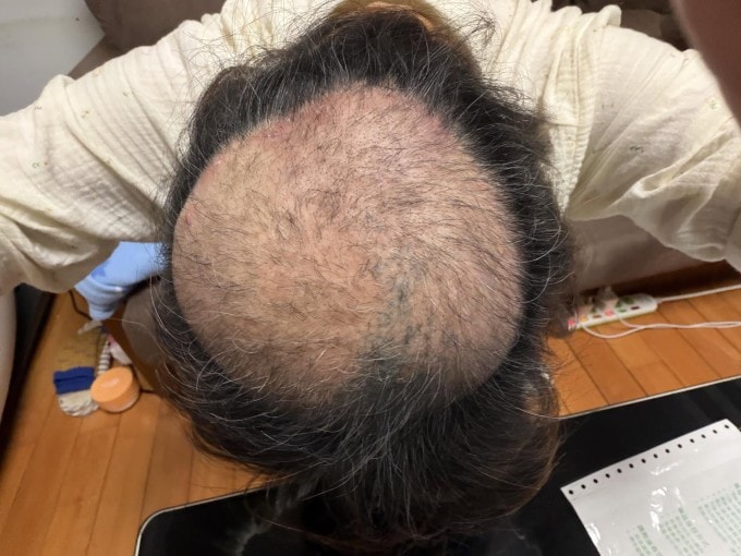 Đội thanh tra môi trường kiểm tra nồng độ mùi tại tiệm đậu hũ thối Ngọc Lý Kiều Đầu tại Đài Bắc.