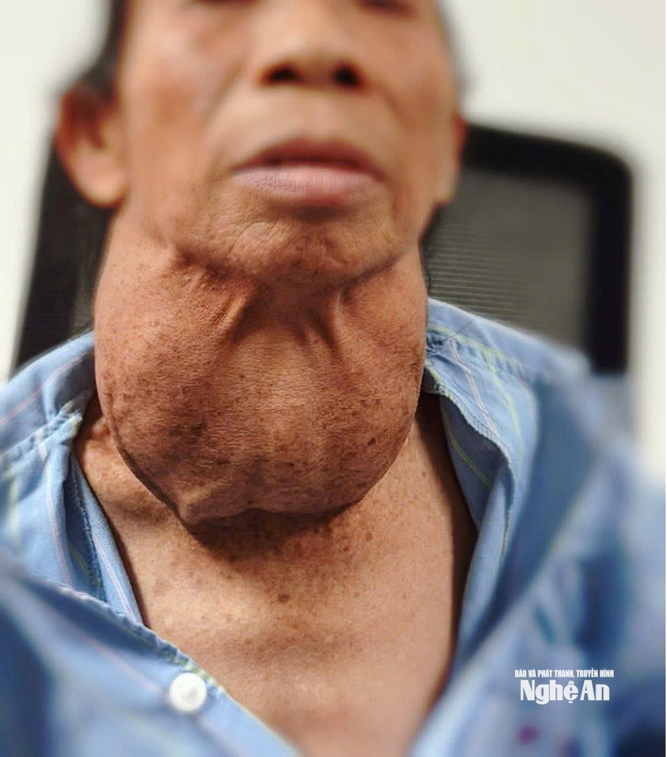 ảnh 1