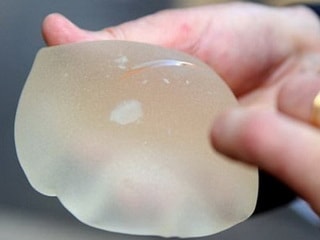 Pháp yêu cầu 30.000 phụ nữ tháo túi nâng ngực nghi gây ung thư