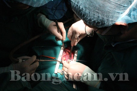 Nghệ An:  Phẫu thuật thành công 2 ca tim hở đầu tiên