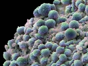 Nhật phát hiện chất điều tiết tốc độ di căn ung thư