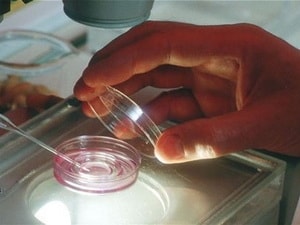 Tìm ra phương pháp điều trị vô sinh từ tế bào gốc