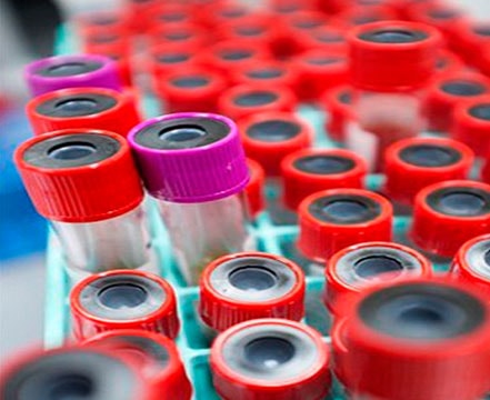 Phát hiện gen gây bệnh ung thư tụy