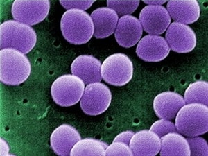 Đẩy mạnh ứng dụng công nghệ kháng khuẩn tại VN