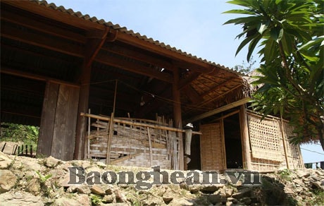 Người phụ nữ bị khối u lớn kỳ lạ