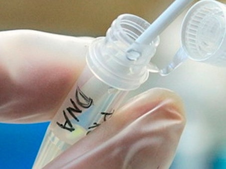 Phát hiện ưu thế của xét nghiệm ADN từ nước bọt