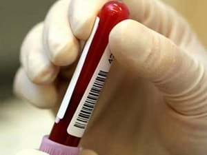 Đã có thể điều trị thành công trẻ sơ sinh nhiễm HIV