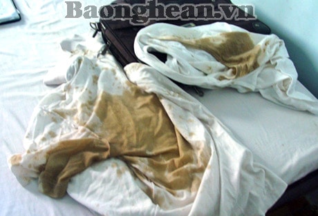 Giám thị bị thí sinh ném chất bẩn vào người