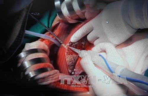 Việt Nam dự Hội thảo khu vực về cấy ghép gan và tủy