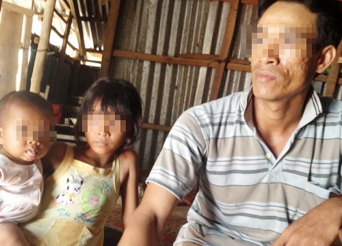 Trốn vợ đi 'hiến' thận lấy 100 triệu đổi đời