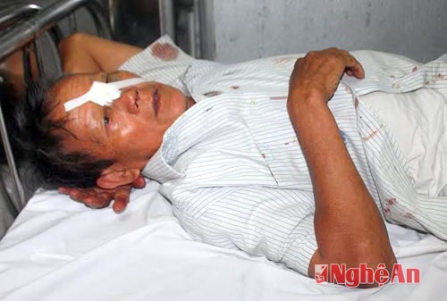 20 nạn nhân vụ TN là cán bộ hưu trí ở Gia Lâm, Hà Nội