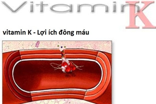 Trẻ xuất huyết não vì thiếu vitamin K