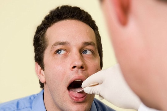 Xét nghiệm nước bọt có thể phát hiện bệnh ung thư