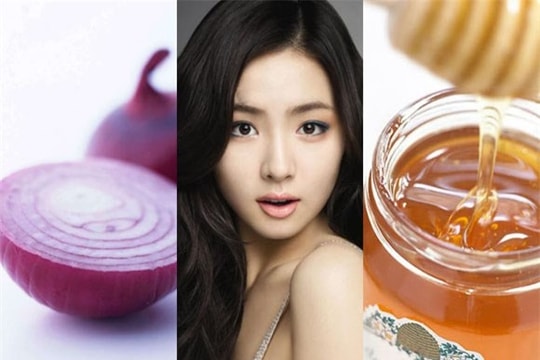 Đẹp da, xóa sẹo mụn bằng hành tây