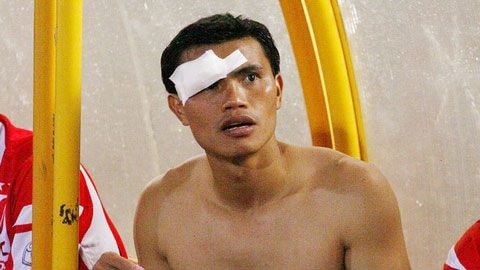 Tài Em khâu 6 mũi ở mí mắt sau trận hòa SLNA