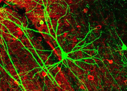 Nơron nhân tạo thay thế dây thần kinh trong não người