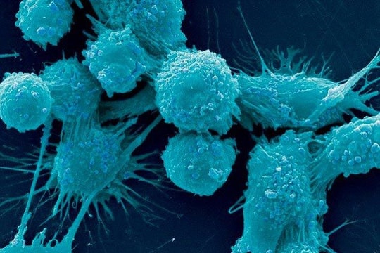 Phát hiện "công tắc" giúp ung thư di căn