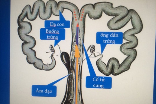 Kỹ thuật phát hiện lợn nái động dục và phối giống
