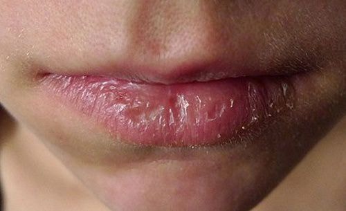 Nguy cơ hỏng môi, ngộ độc chì từ son môi kém chất lượng