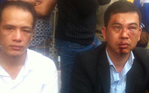 Đoàn luật sư Hà Nội lên tiếng vụ hai luật sư bị hành hung