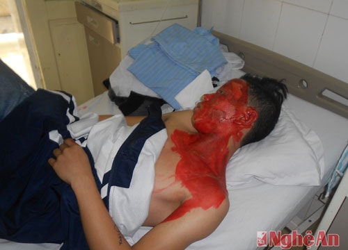 Tự chế thuốc pháo, nam thanh niên rước họa vào thân