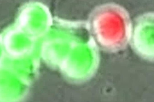 Đột phá mới trong chữa trị ung thư