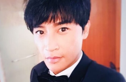 Gương mặt tài tử 'Hoàn Châu cách cách' biến dạng vì bỏng nặng