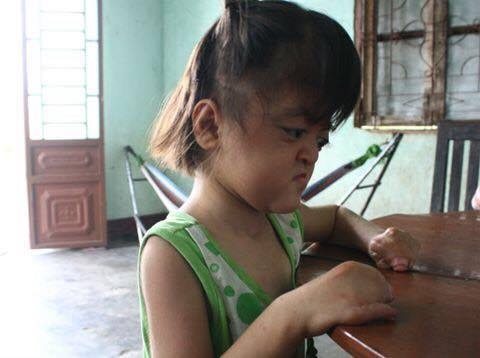 Bác sĩ rao trên Facebook tìm cô bé dị tật tay chân để xin mổ