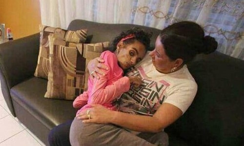 Thiếu nữ hỏng não sau khi nâng ngực