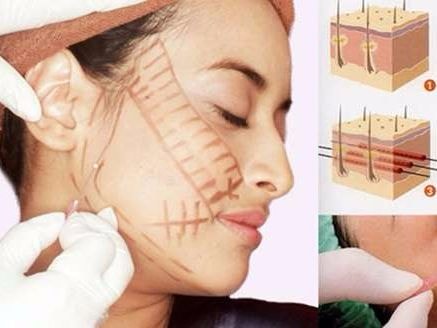 Sai lầm khi sử dụng collagen