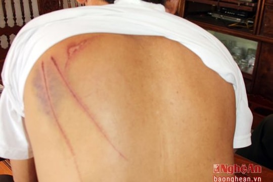 Nghịch tử đuổi mẹ ra khỏi nhà, chém công an viên