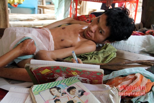 Quặn lòng 'thi sỹ viết một tay'