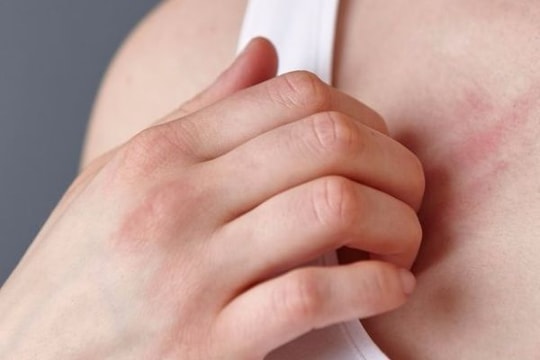 9 thay đổi trên da cảnh báo bệnh nguy hiểm