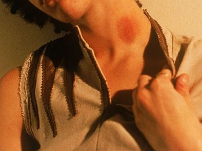 Nam thanh niên 17 tuổi tử vong vì nụ hôn của bạn gái