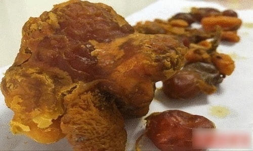 Dị vật trong bụng gà trị giá hàng trăm nghìn USD