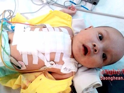 Hơn 22 triệu đồng ủng hộ cháu bé bị bệnh tim bẩm sinh