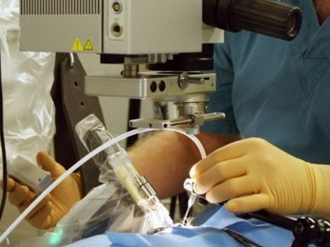 Robot phẫu thuật mắt cho bệnh nhân