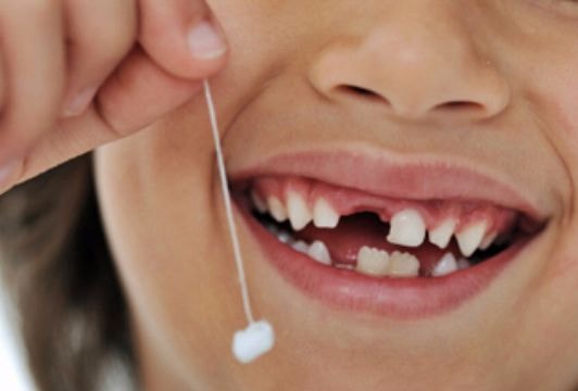 'Choáng' cách bé 5 tuối tự nhổ răng sữa