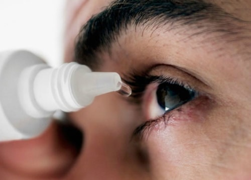 Phòng đau mắt đỏ khi thời tiết thay đổi