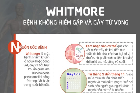 Whitmore - bệnh gây tử vong cao nhưng ít người biết