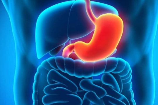 [Infographic] Những món ăn có hại cho người bị đau dạ dày