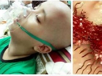 GS đầu ngành điểm mặt những loại thực phẩm gây ung thư nhiều nhất hiện nay