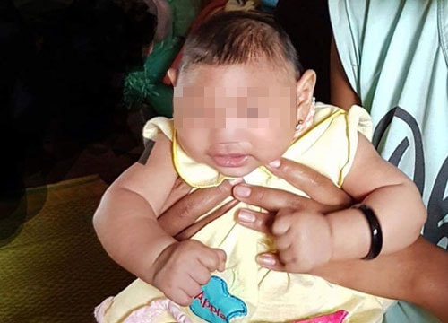Em bé Việt Nam đầu tiên nghi bị dị tật đầu nhỏ do virus Zika