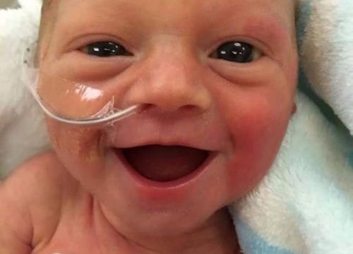 Nụ cười hạnh phúc của em bé sinh non mới 5 ngày tuổi