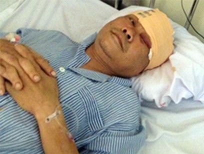 Côn đồ chém trọng thương trung tá công an