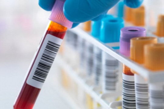 Phát hiện kháng thể vô hiệu hóa được 98% các chủng virus HIV