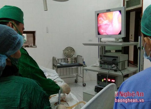 Bóc khối u xơ tử cung hơn 1kg trên cơ thể người phụ nữ 50 tuổi