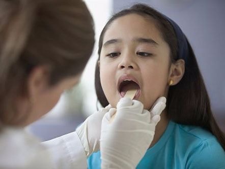 Lúc nào cần mổ cắt amidan?