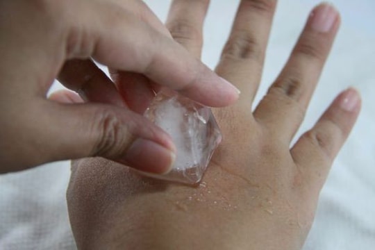 Đá lạnh - 5 phút làm cơn đau răng tan biến